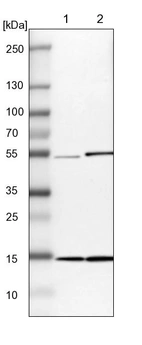 Lane 1: NIH-3T3 cell lysate (Mouse embryonic fibroblast cells)_br/_Lane 2: NBT-II cell lysate (Rat Wistar bladder tumour cells)