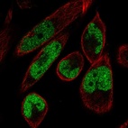 Anti-MAMLD1 Antibody