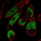 Immunofluorescent staining of human cell line RH-30 shows localization to nucleoplasm.