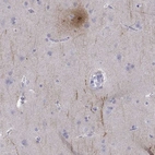 Immunohistochemical staining of human cerebral cortex shows strong positivity in neuronal processes.