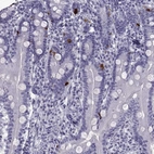 Immunohistochemical staining of human gastrointestinal shows strong cytoplasmic positivity in enteroendocrine cells.