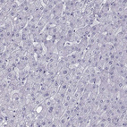 Immunohistochemical staining of human liver shows no positivity in hepatocytes as expected.