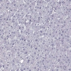 Immunohistochemical staining of human liver shows no positivity in hepatocytes as expected.