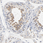 Anti-LMAN2 Antibody