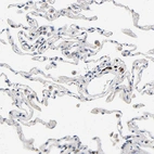 Immunohistochemical staining of human lung shows weak to moderate cytoplasmic positivity in macrophages.