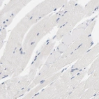 Immunohistochemical staining of human skeletal muscle shows no positivity in myocytes as expected.