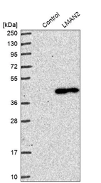 Western blot analysis in control (vector only transfected HEK293T lysate) and LMAN2 over-expression lysate (Co-expressed with a C-terminal myc-DDK tag (~3.1 kDa) in mammalian HEK293T cells, LY416403).