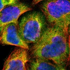 Immunofluorescent staining of human cell line A-431 shows localization to cytosol.