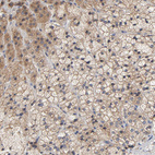 Anti-CCDC134 Antibody