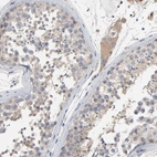 Immunohistochemical staining of human Testis shows moderate cytoplasmic positivity in spermatogonia and Leydig cells.