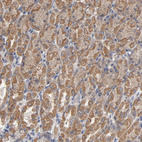 Anti-CCDC134 Antibody