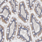 Anti-CCDC134 Antibody