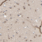 Anti-DYNLT3 Antibody