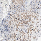 Immunohistochemical staining of human placenta shows moderate cytoplasmic positivity in decidual cells.