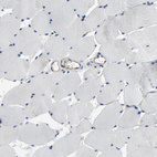 Anti-DYNLT3 Antibody