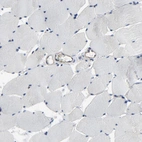 Immunohistochemical staining of human skeletal muscle shows no positivity in myocytes as expected