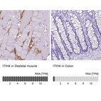 Anti-ITIH4 Antibody