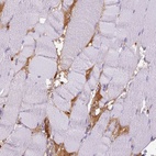 Immunohistochemical staining of human skeletal muscle shows high expression.