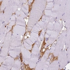 Immunohistochemical staining of human skeletal muscle shows high expression.