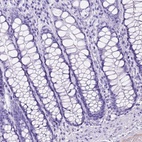 Anti-ITIH4 Antibody