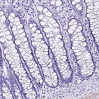 Immunohistochemical staining of human colon shows low expression as expected.