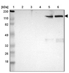 Lane 1: Marker [kDa] 230, 110, 82, 49, 32, 26, 18_br/_Lane 2: Human cell line RT-4_br/_Lane 3: Human cell line U-251MG sp_br/_Lane 4: Human plasma (IgG/HSA depleted)_br/_Lane 5: Human liver tissue_br/_Lane 6: Human tonsil tissue