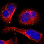 Immunofluorescent staining of human cell line U-2 OS shows localization to vesicles.