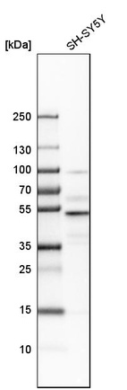 Anti-NFIB Antibody