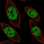 Immunofluorescent staining of human cell line PC-3 shows localization to nucleoplasm.