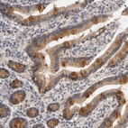 Anti-PDZD11 Antibody
