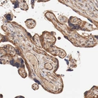 Immunohistochemical staining of human placenta shows strong cytoplasmic positivity in trophoblastic cells.