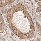 Immunohistochemical staining of human testis shows moderate cytoplasmic positivity in cells in seminiferous ducts.