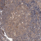 Immunohistochemical staining of human tonsil shows weak cytoplasmic positivity in germinal center cells.