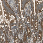 Anti-RARS Antibody