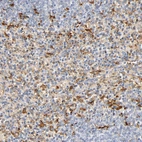 Immunohistochemical staining of human spleen shows moderate cytoplasmic positivity.