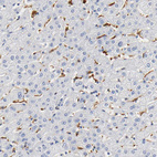 Anti-IL18 Antibody