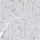 Immunohistochemical staining of human skeletal muscle shows no positivity in myocytes as expected.