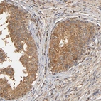 Immunohistochemical staining of human prostate shows moderate cytoplasmic and membranous positivity in glandular cells.