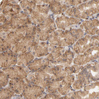 Immunohistochemical staining of human stomach shows moderate cytoplasmic and membranous positivity in glandular cells.