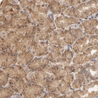 Immunohistochemical staining of human stomach shows moderate cytoplasmic and membranous positivity in glandular cells.