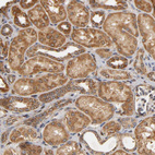 Anti-PKN1 Antibody