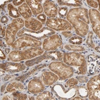 Immunohistochemical staining of human kidney moderate cytoplasmic positivity in cells in tubules.