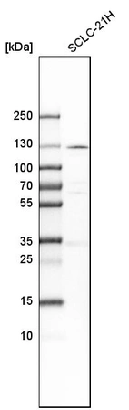 Western blot analysis in human cell line SCLC-21H.