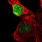 Immunofluorescent staining of human cell line A-431 shows localization to nucleus.
