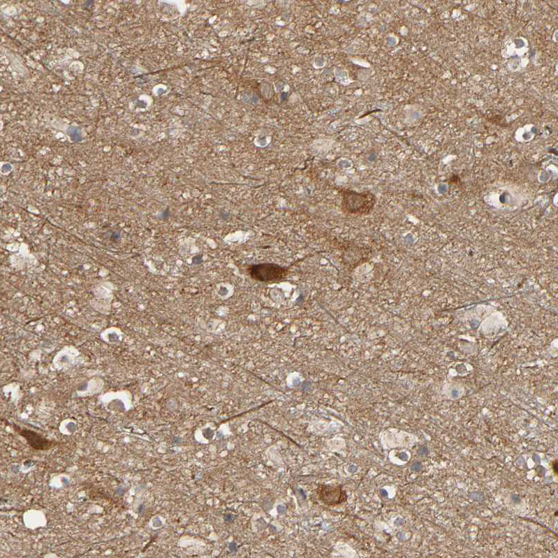 Anti-SGSM1 Antibody
