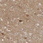 Anti-SGSM1 Antibody
