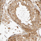 Immunohistochemical staining of human testis shows moderate cytoplasmic positivity in cells in seminiferous ducts.