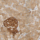 Anti-SGSM1 Antibody