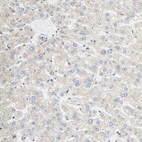 Immunohistochemical staining of human liver shows no positivity in hepatocytes.