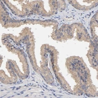 Immunohistochemical staining of human prostate shows weak membranous positivity in glandular cells.